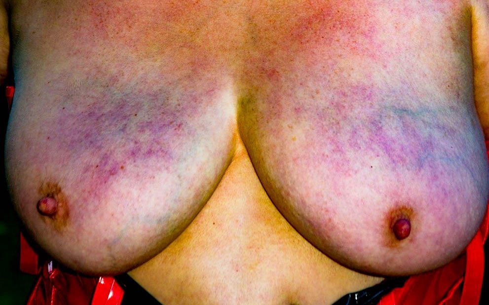 Kleinschuh aus Berlin,Deutschland